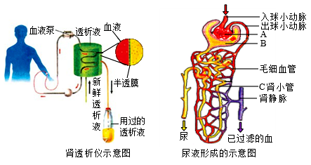 人工肾工作原理图图片