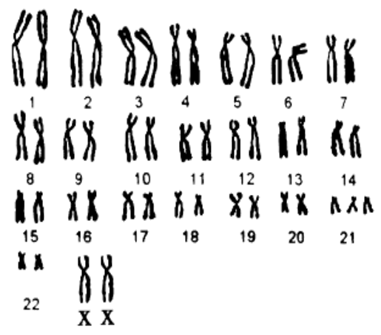 图为某一遗传病患者体细胞内全部染色体的图像，下列叙述正确的是A.该图为显微镜下观察到的女性染色体核型图B.该细胞处于有丝分裂中期C.图中染色体共有23种形态D.