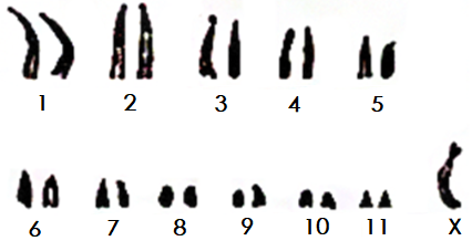 性染色体xo图片