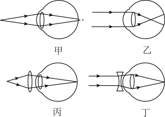 下列圖中能夠說明遠視眼的成像原理的是圖