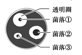 纤维素分解菌的培养基中加入刚果红染料研究者观察到几个有透明圈的